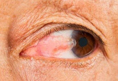 Laser Eye Surgery Cost Guide: What You'll Pay for Vision Correction in the UK