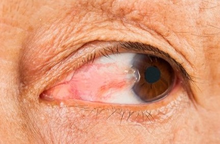 Laser Eye Surgery Cost Guide: What You'll Pay for Vision Correction in the UK